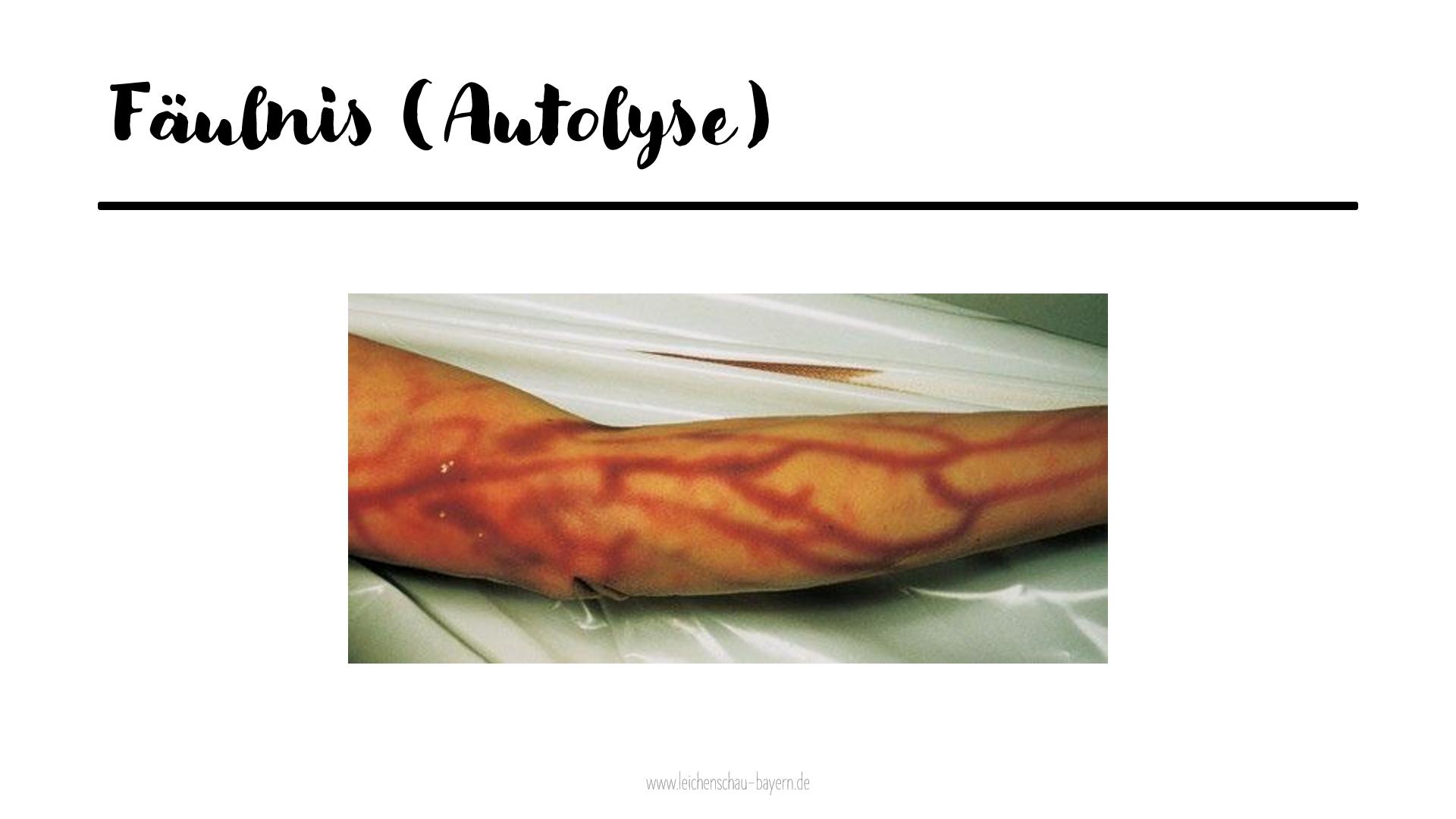 Fortbildung Vorträge zum Thema Ärztliche Leichenschau in München und